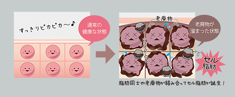 通常の健康な状態と、老廃物が溜まった状態を比較