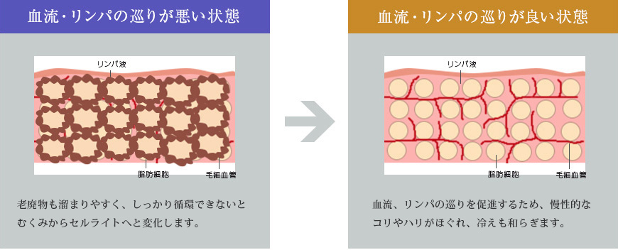 血流・リンパの巡りが悪い状態から血流・リンパの巡りが良い状態へ