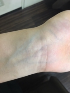 Wrist blood vessels  http://www.ankh-jp.com
