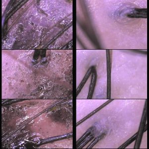 Scalp cleansing: before and after     http://www.ankh-jp.com