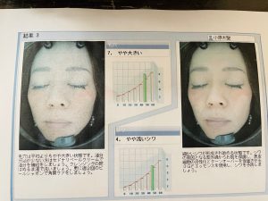 あんく　自由が丘クリニック　ドクターズコスメ　肌診断　https://www.ankh-jp.com/beauty-esthetic-menu/doctors-cosme/