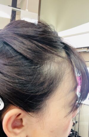 肩こり　首こり　緩和　白髪をへらす　https://www.ankh-jp.com/ankh-menu-blog/23scalp-cleaning/9836/