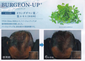 白髪を黒毛へ　ハーブマジックスキャルプセラムV　優秀開発者賞を受賞　https://www.ankh-jp.com/ankh-menu-blog/23scalp-cleaning/10995/